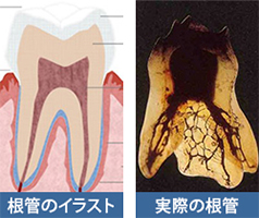 実際の歯の根の形