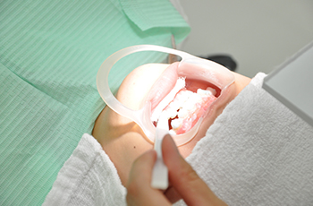 歯の白さが加速するデュアルホワイトニング